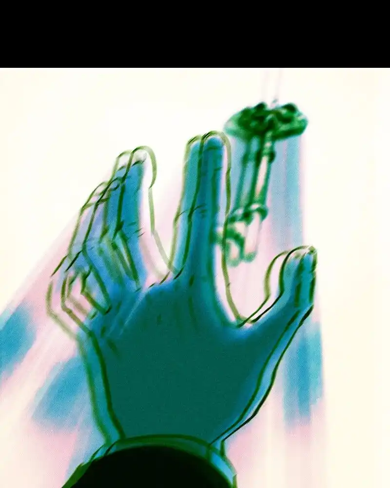 31